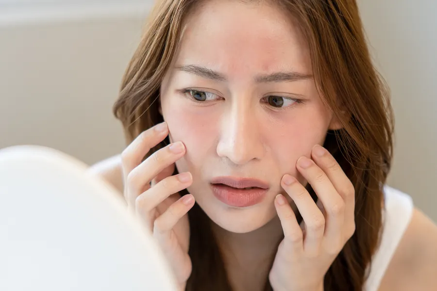 Pele Sensível: 7 Cuidados Essenciais e Tratamentos Dermatológicos